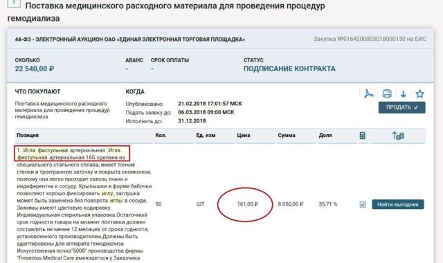 Діалізна маржа для СБУ 5 tab4
