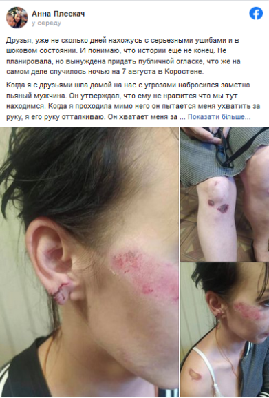Депутата-"слугу" обвиняют в нападении на женщину 1 8ae26cba2f9f7f872b7d51e04dcf0195